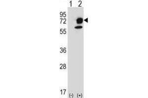 Western Blotting (WB) image for anti-Inositol-Trisphosphate 3-Kinase B (ITPKB) antibody (ABIN3003734) (ITPKB Antikörper)