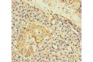 Immunohistochemistry of paraffin-embedded human pancreatic tissue using ABIN7143774 at dilution of 1:100 (A4GNT Antikörper  (AA 26-340))