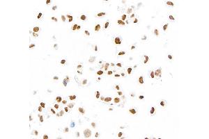 Immunocytochemistry (ICC) image for anti-MutS Homolog 6 (E. Coli) (MSH6) (AA 1310-1360) antibody (ABIN7453979)