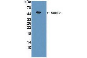 Detection of Recombinant MMP19, Human using Polyclonal Antibody to Matrix Metalloproteinase 19 (MMP19) (MMP19 Antikörper  (AA 98-508))