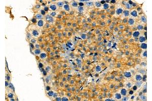 ABIN6261469 and ABIN6278061 at 1/100 staining Mouse testis tissue by IHC-P.