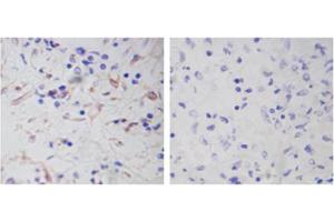Immunohistochemistry analysis of human spleen tissue slide (Paraffin embedded) using Rabbit Anti-Vimentin Polyclonal Antibody (Left, ABIN398721) and Purified Rabbit IgG (Whole molecule) Control (Right, ABIN398653) (Vimentin Antikörper  (AA 400-500))