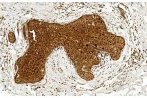 Immunohistochemistry (IHC) image for anti-BCL6 Co-Repressor (BCOR) (AA 1107-1137) antibody (ABIN391538)