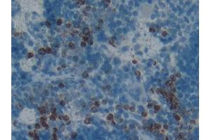 DAB staining on IHC-P; Samples: Rat Spleen Tissue (PGLYRP1 Antikörper  (AA 18-183))