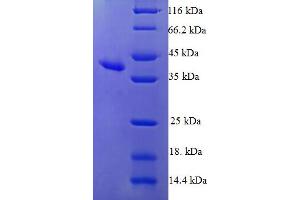 SDS-PAGE (SDS) image for Heat-Responsive Protein 12 (HRSP12) (AA 2-137) protein (GST tag) (ABIN5709685) (HRSP12 Protein (AA 2-137) (GST tag))