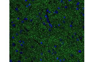 Indirect immunostaining of PFA fixed paraffin embedded mouse spinal cord section (dilution 1 : 500; green). (Alpha, beta Synuclein (AA 1-140) Antikörper)
