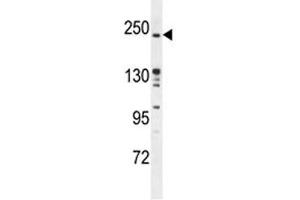 RICTOR antibody western blot analysis in mouse bladder tissue lysate. (RICTOR Antikörper  (AA 805-835))