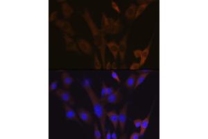 Immunofluorescence analysis of NIH-3T3 cells using  Rabbit mAb (ABIN7265739) at dilution of 1:100 (40x lens). (ABCE1 Antikörper)