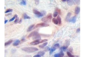 Image no. 1 for anti-Melanoma Inhibitory Activity (MIA) antibody (ABIN464851) (MIA Antikörper)
