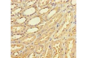 Immunohistochemistry of paraffin-embedded human kidney tissue using ABIN7171552 at dilution of 1:100 (TAS2R42 Antikörper  (AA 149-187))