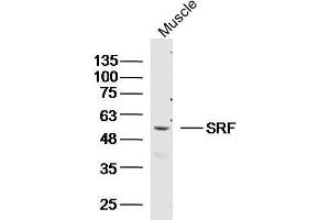 SRF Antikörper  (AA 101-250)