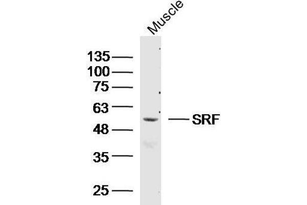 SRF Antikörper  (AA 101-250)