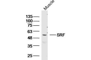 Mouse muscle lysates probed with SRF Polyclonal Antibody, unconjugated  at 1:300 overnight at 4°C followed by a conjugated secondary antibody at 1:10000 for 90 minutes at 37°C. (SRF Antikörper  (AA 101-250))