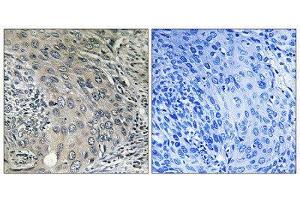 Immunohistochemistry (IHC) image for anti-Coatomer Protein Complex, Subunit zeta 1 (COPZ1) (N-Term) antibody (ABIN1851138) (COPZ1 Antikörper  (N-Term))
