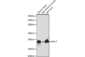Western blot analysis of extracts of various cell lines, using MYL2 Rabbit mAb (ABIN7268761) at 1:1000 dilution. (MYL2 Antikörper)