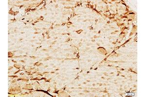 Formalin-fixed and paraffin embedded mouse liver tissue labeled with Anti-TIMP-3 Polyclonal Antibody , Unconjugated at 1:100, followed by conjugation to the secondary antibody and DAB staining (TIMP3 Antikörper  (AA 151-211))