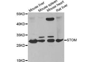 Western blot analysis of extracts of various cell lines, using STOM antibody (ABIN5973779) at 1/1000 dilution. (Stomatin Antikörper)
