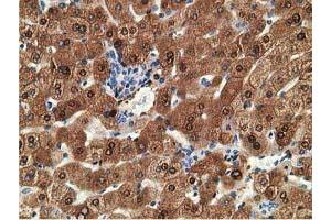 Immunohistochemical staining of paraffin-embedded Human liver tissue using anti-ADH1B mouse monoclonal antibody. (ADH1B Antikörper)