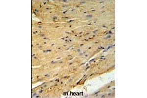 PLB-T17 Antibody (ABIN653840 and ABIN2843104) IHC analysis in formalin fixed and paraffin embedded mouse heart tissue followed by peroxidase conjugation of the secondary antibody and DAB staining. (PLB-T17 (AA 1-30) Antikörper)