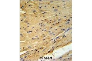 PLB-T17 Antibody (ABIN653840 and ABIN2843104) IHC analysis in formalin fixed and paraffin embedded mouse heart tissue followed by peroxidase conjugation of the secondary antibody and DAB staining. (PLB-T17 (AA 1-30) Antikörper)