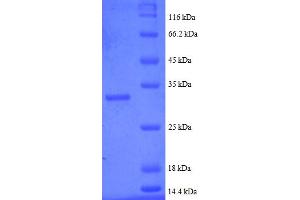 SDS-PAGE (SDS) image for Metallothionein 2 (MT2) (AA 1-59), (partial) protein (GST tag) (ABIN5713082)