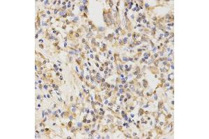 Immunohistochemistry (IHC) image for anti-ATG5 Autophagy Related 5 (ATG5) (AA 1-275) antibody (ABIN3020674)