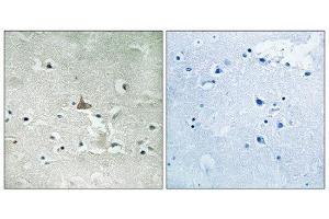 Immunohistochemistry (IHC) image for anti-Neurotrophic Tyrosine Kinase, Receptor, Type 2 (NTRK2) (pTyr706), (pTyr707) antibody (ABIN1847660) (TRKB Antikörper  (pTyr706, pTyr707))