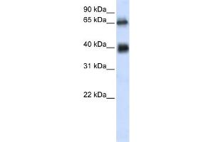 WB Suggested Anti-C6orf113 Antibody Titration:  0. (ZUFSP Antikörper  (Middle Region))