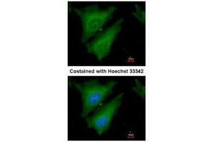 ICC/IF Image Immunofluorescence analysis of paraformaldehyde-fixed HeLa, using SOCS4, antibody at 1:200 dilution. (SOCS4 Antikörper  (C-Term))