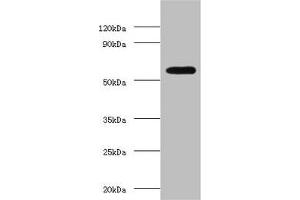 Western blot All lanes: OXCT1 antibody at 2 μg/mL + Hela whole cell lysate Secondary Goat polyclonal to rabbit IgG at 1/15000 dilution Predicted band size: 57, 14 kDa Observed band size: 57 kDa (OXCT1 Antikörper  (AA 40-520))