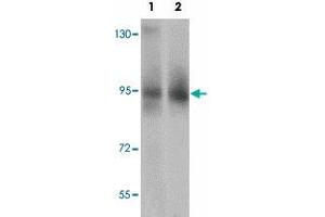 Western blot analysis of ZBTB5 in mouse brain tissue lysate with ZBTB5 polyclonal antibody  at (1) 1 and (2) 2 ug/mL. (ZBTB5 Antikörper  (C-Term))