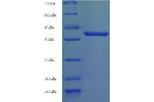 SDS-PAGE (SDS) image for Gem (Nuclear Organelle) Associated Protein 7 (GEMIN7) (AA 1-131), (full length) protein (GST tag) (ABIN5711759)