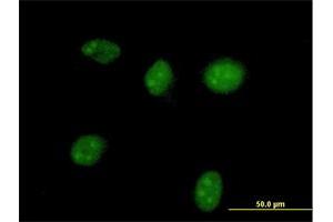 Immunofluorescence of purified MaxPab antibody to HGD on HeLa cell. (HGD Antikörper  (AA 1-445))