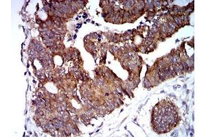 Immunohistochemistry (IHC) image for anti-Tripartite Motif Containing 25 (TRIM25) (AA 211-360) antibody (ABIN5542675)