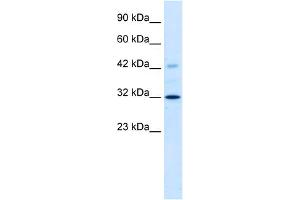 WB Suggested Anti-VDAC1 Antibody Titration:  1. (VDAC1 Antikörper  (C-Term))