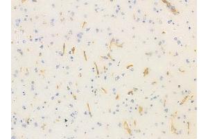 ABIN6258344 and ABIN6275543 at 1/100 staining human glioblastoma by IHC-P. (ULK3 Antikörper  (Internal Region))