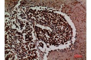 Immunohistochemistry (IHC) image for anti-Intercellular Adhesion Molecule 3 (ICAM3) (Internal Region) antibody (ABIN6282682)