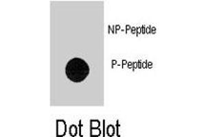 Dot blot analysis of TEK (phospho Y1113) polyclonal antibody  on nitrocellulose membrane. (TEK Antikörper  (pTyr1113))