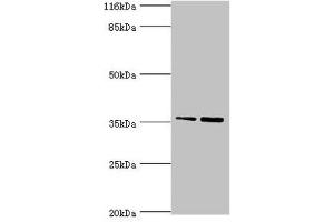 Western blot All lanes: CFHR2 antibody at 2 μg/mL Lane 1: Hela whole cell lysate Lane 2: 293T whole cell lysate Secondary Goat polyclonal to rabbit IgG at 1/10000 dilution Predicted band size: 31, 28 kDa Observed band size: 36 kDa (CFHR2 Antikörper  (AA 20-269))