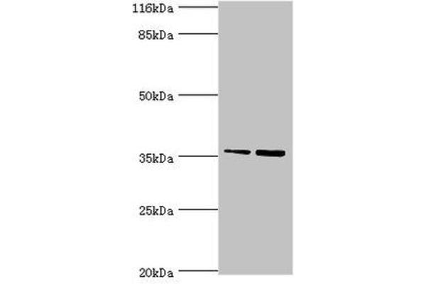 CFHR2 Antikörper  (AA 20-269)