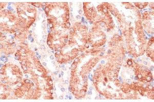 Immunohistochemistry of paraffin-embedded Rat kidney using RPIA Polyclonal Antibody at dilution of 1:100 (40x lens). (Ribose 5-Phosphate Isomerase A (RPIA) Antikörper)