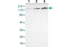 Western blot analysis of Lane 1: RT-4 cell lysate, Lane 2: U-251 MG sp cell lysate, Lane 3: A-431 cell lysate with WDHD1 polyclonal antibody at 1:250 - 1:500 dilution.