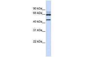 DDX47 antibody used at 1 ug/ml to detect target protein. (DDX47 Antikörper)