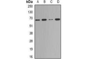 Western blot analysis of Deltex-2 expression in Jurkat (A), HepG2 (B), mouse testis (C), mouse spleen (D) whole cell lysates. (DTX2 Antikörper)
