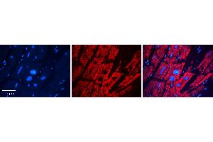 Rabbit Anti-DHCR24 Antibody   Formalin Fixed Paraffin Embedded Tissue: Human heart Tissue Observed Staining: Cytoplasmic Primary Antibody Concentration: 1:100 Other Working Concentrations: 1:600 Secondary Antibody: Donkey anti-Rabbit-Cy3 Secondary Antibody Concentration: 1:200 Magnification: 20X Exposure Time: 0.