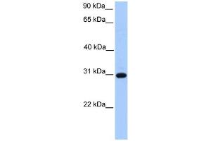 WB Suggested Anti-ETFB Antibody Titration: 0. (ETFB Antikörper  (C-Term))