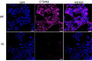 Immunocytochemical staining of HeLa cells using EIF2AK2 antibody (ABIN7798506), 1:1,000), Top panel: wild-type (WT), Bottom panal: EIF2AK2 shRNA knockdown (KD).