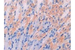 Immunohistochemistry (IHC) image for anti-CD47 (CD47) (AA 18-219) antibody (ABIN7439102)
