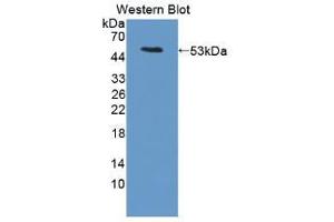 Western blot analysis of the recombinant protein. (LRG1 Antikörper  (AA 136-342))