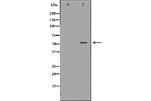 Western blot analysis of Hela whole cell lysates, using TRAF2  Antibody. (TRAF2 Antikörper  (C-Term))